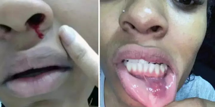 Patrícia Ramos diz que pagou R$400 mil para que ex assinasse o divórcio