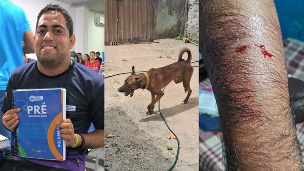 Estudante autista é atacado por cachorro a caminho da prova do Enem, no Pará