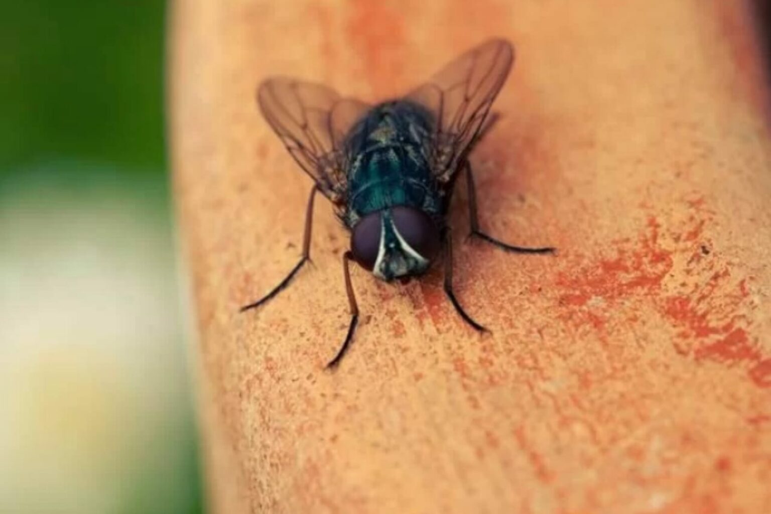 Mosca viva é encontrada dentro de intestino de homem durante exame