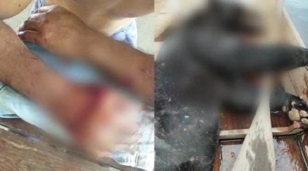 Pescador quase perde as duas mãos após ataque de onça no Pará