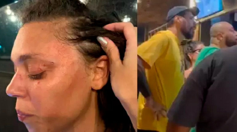 Mulher é agredida em restaurante de Recife após cliente pensar que ela era trans