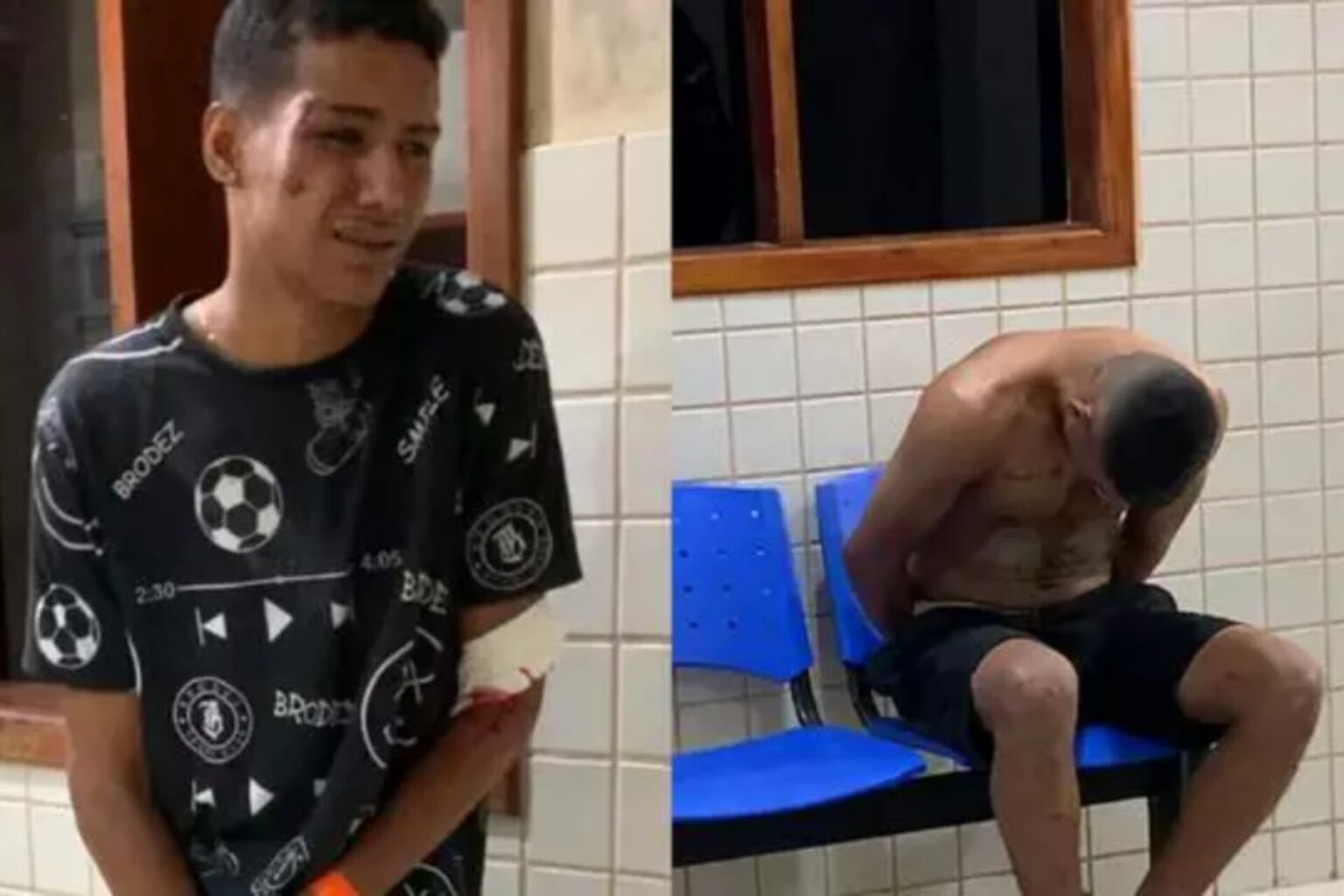 Dupla em motocicleta colide contra poste e acaba presa no Pará