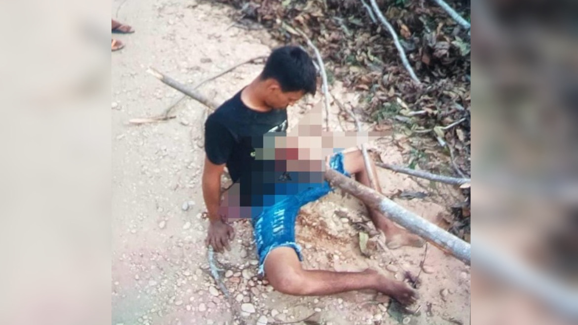 Jovem que teve tronco atravessado em acidente de moto morre após 20 dias internado