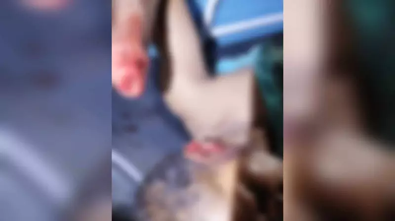 Homem tem mão decepada e orelha cortada no Pará