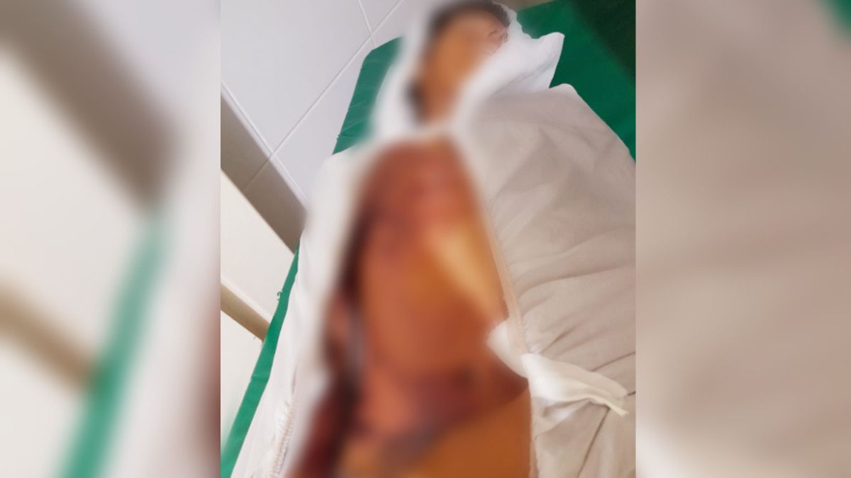 Dupla troca tiros com a PM e “leva a pior” em Itupiranga