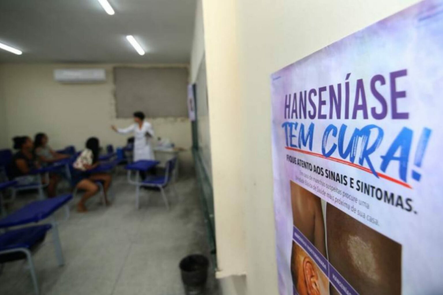 Sespa inicia campanha do “Janeiro Roxo” para conscientizar população sobre hanseníase