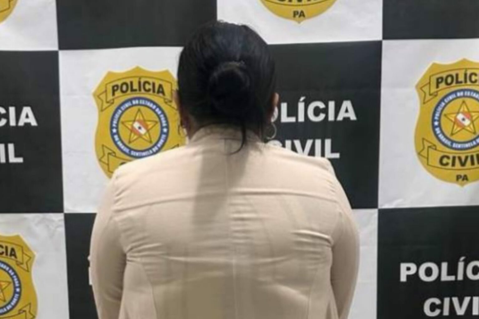 Polícia Civil prende falsa biomédica após denúncia de procedimentos no Pará