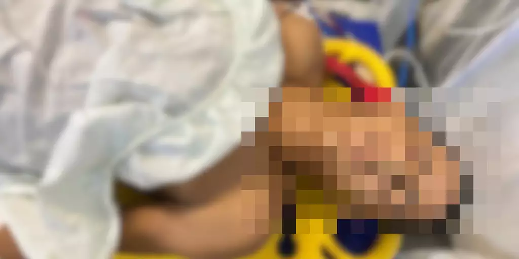 Homem é alvo de ataque a tiros em bar de Parauapebas