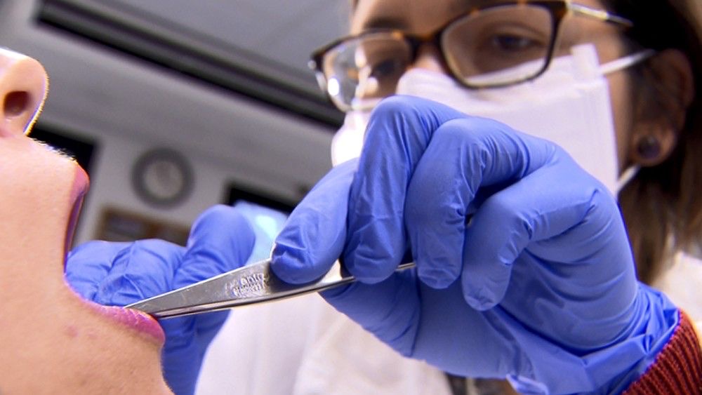‘Maio Vermelho’: Casos de câncer de boca crescem 22% no Pará