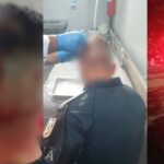 Policial Militar é atingido com pedrada na cabeça durante intervenção no Pará