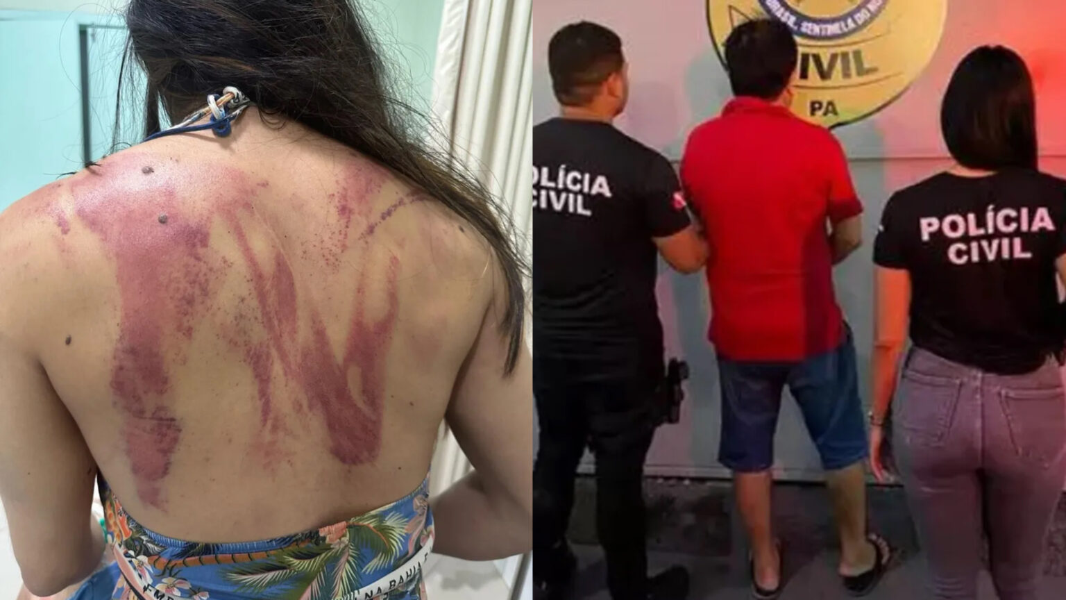 Mulher quase foi morta pelo próprio pai no interior do Pará