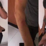 Homem é agredido a tijoladas ao buscar roupas na casa da ex em Parauapebas