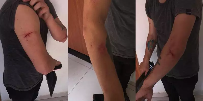 Homem é agredido a tijoladas ao buscar roupas na casa da ex em Parauapebas