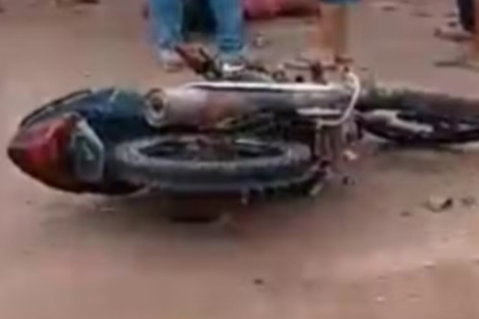Grave acidente deixa homem com fratura exposta na BR-230