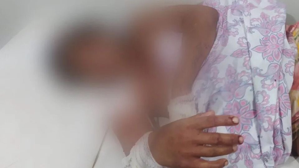 Mulher tem dedos da mão decepados após desentendimento no Pará