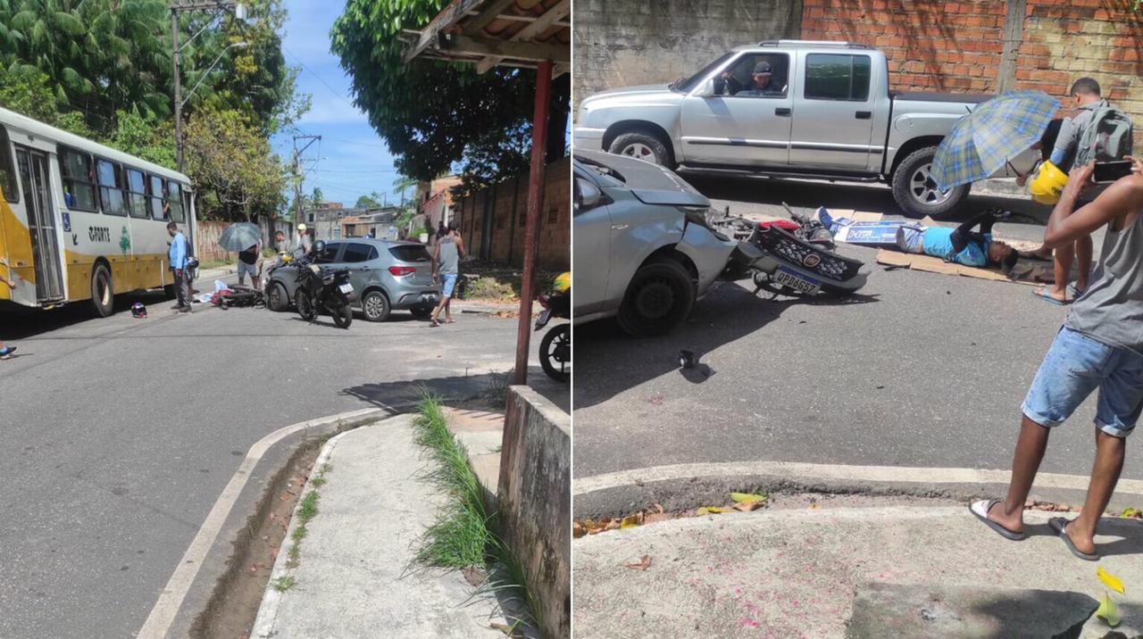 Motoqueiro fratura a perna em acidente grave no Pará