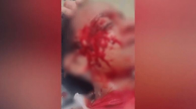 Homem agride criança com paulada no rosto ao tentar bater na ex no Pará