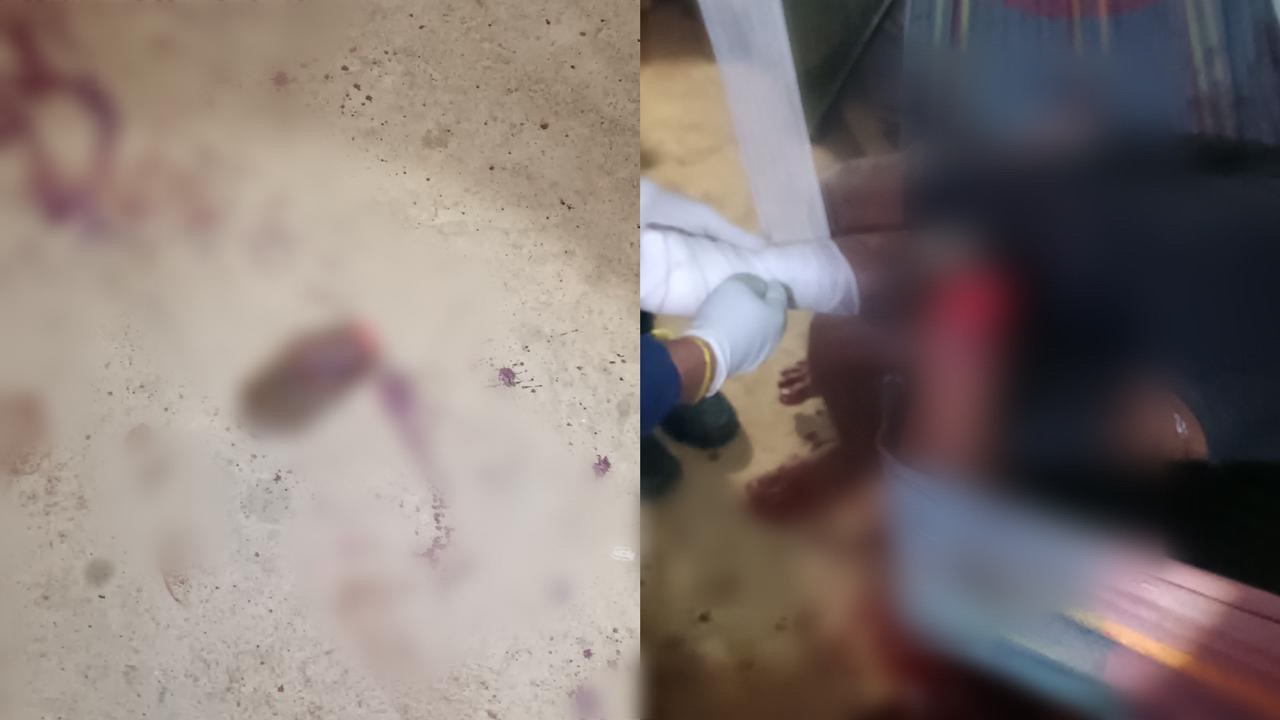 Homem decepa a mão de vizinho após ser chamado de “boca de pelo” em Tucuruí