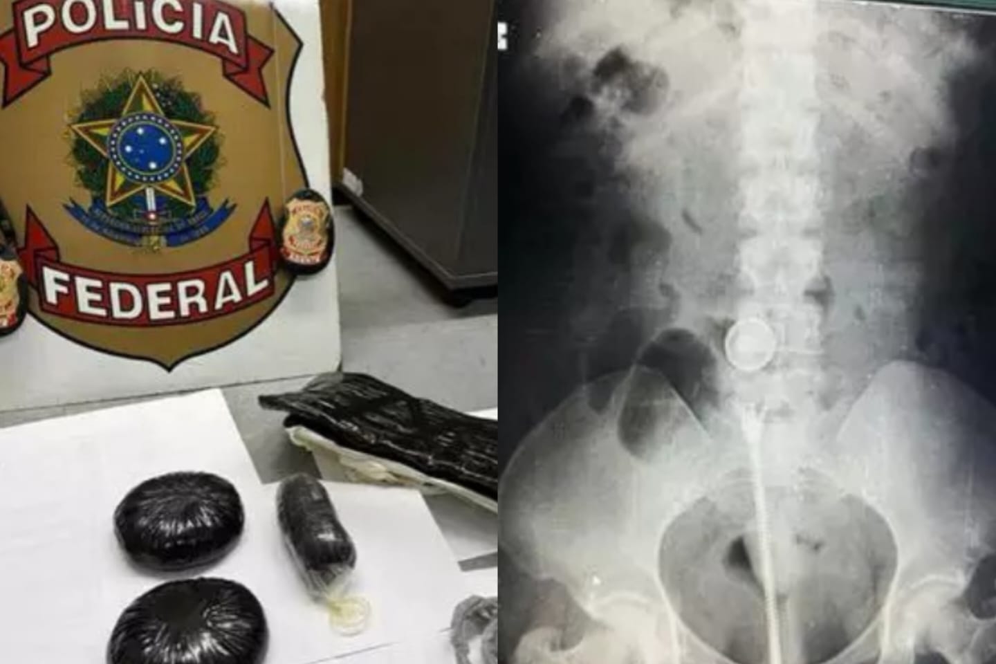 Mãe e filha são presas com drogas pelo corpo em aeroporto no Pará
