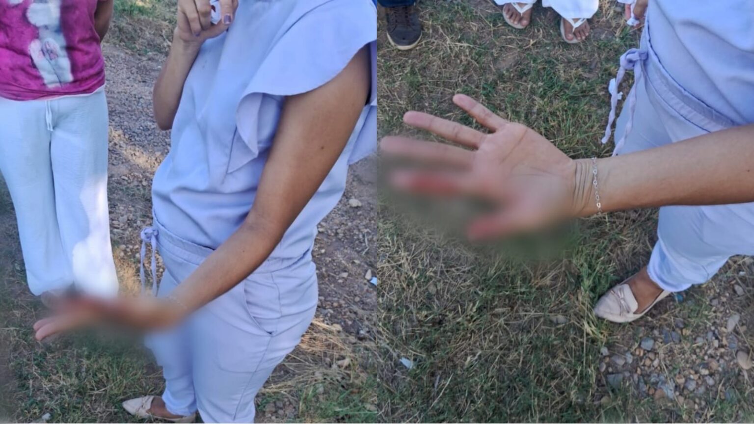 Motociclista grávida sofre acidente com linha de cerol em Marabá