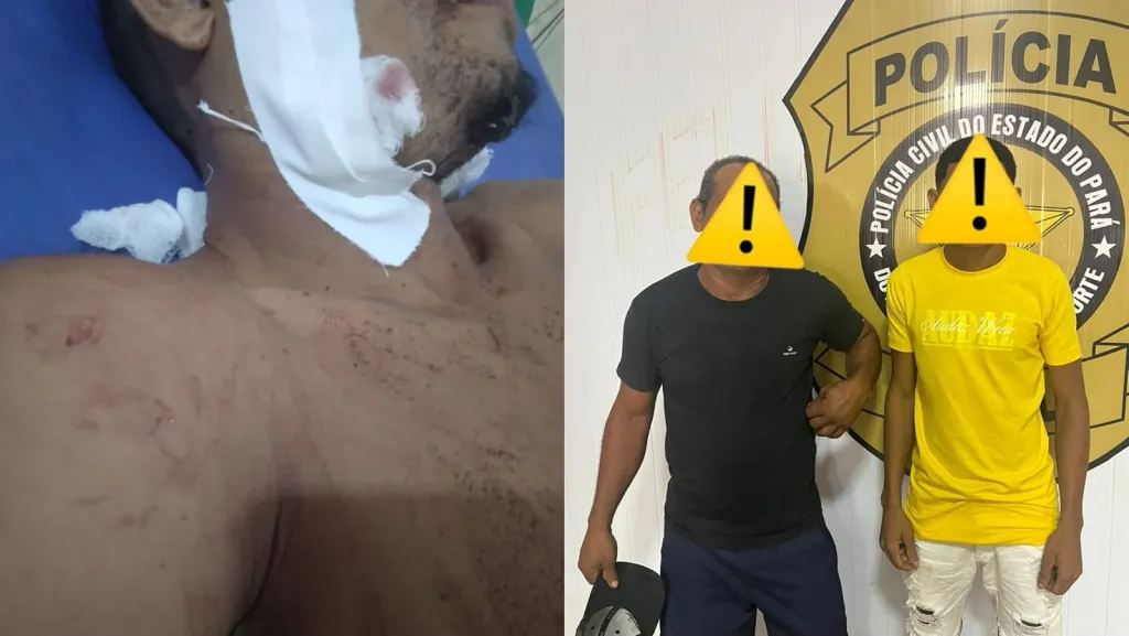 Padrasto tenta matar enteado durante briga no Pará