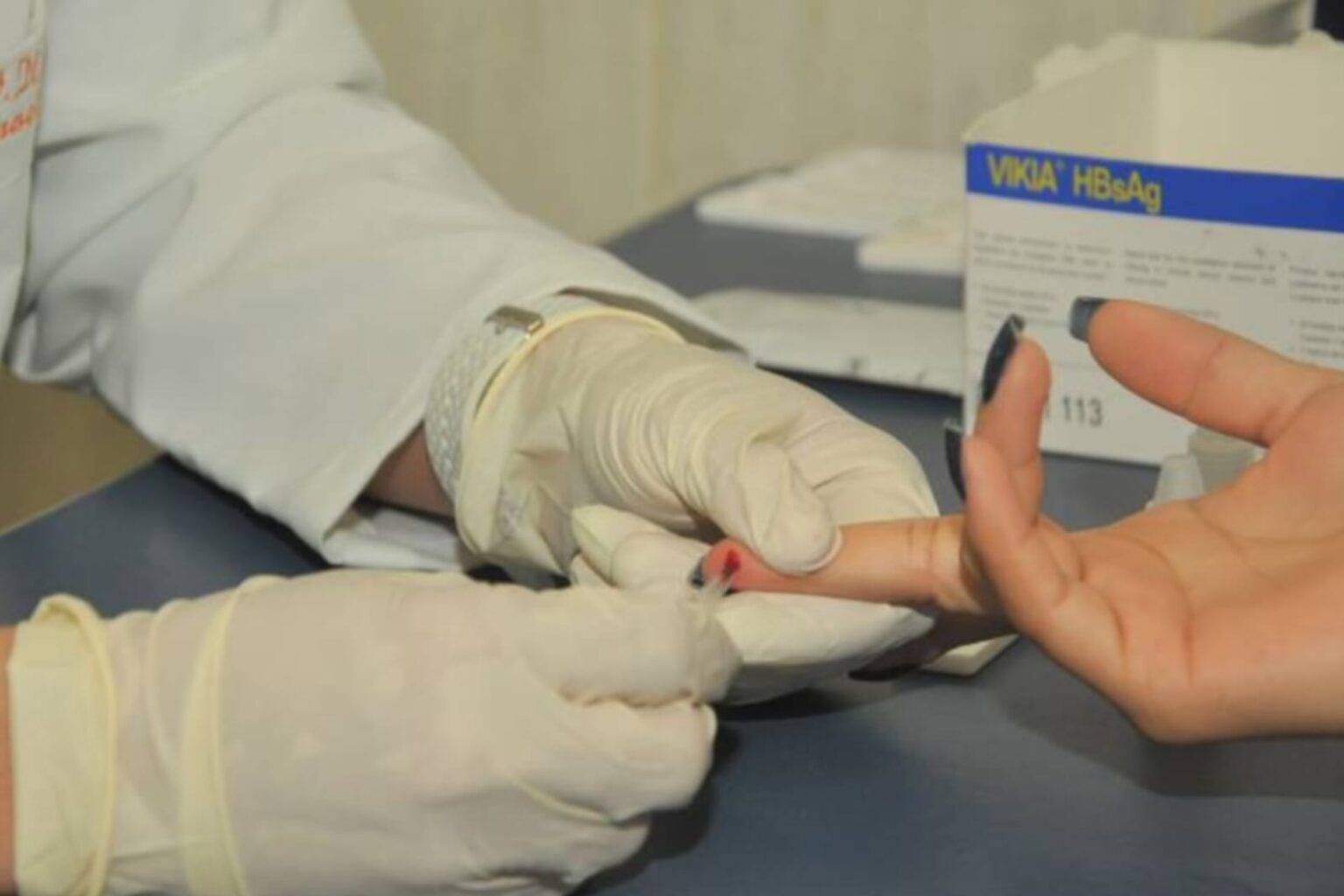 Sespa alerta a população para a prevenção das hepatites virais
