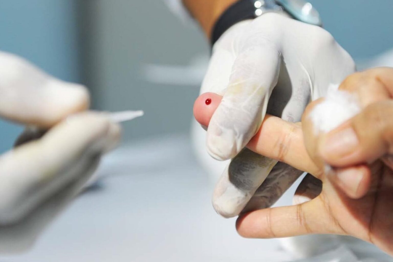 Pará registra 229 casos de hepatites virais no primeiro semestre de 2024, diz Sespa