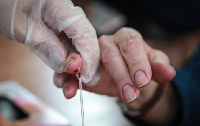Pará inicia testagem inédita da hepatite D nesta quinta-feira