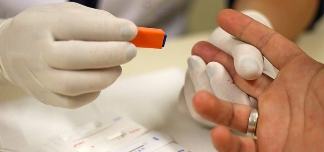 Nova variante do HIV é detectada em três estados do Brasil