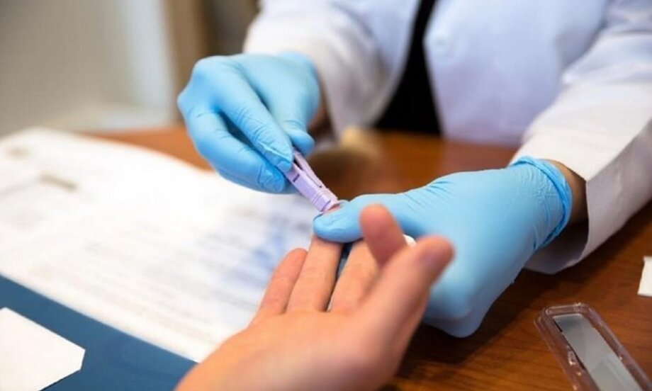 Nova variante do HIV está circulando em pelo menos 3 estados brasileiros