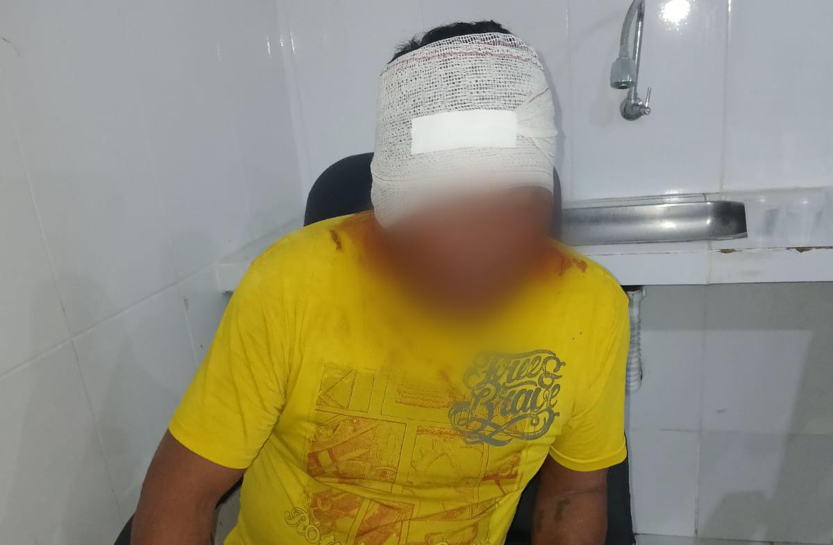 Briga em bar termina com tijolada na cabeça e dois presos no Pará