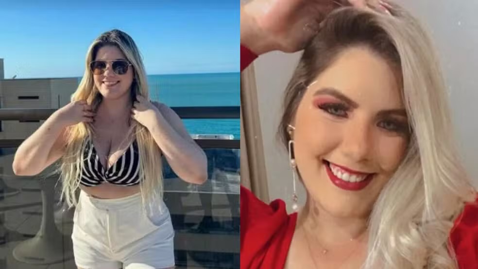 Mulher de 24 anos morre após fazer seis cirurgias plásticas simultâneas