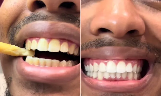 Miswak: galho faz você ter dentes de artista sem investir milhares de reais