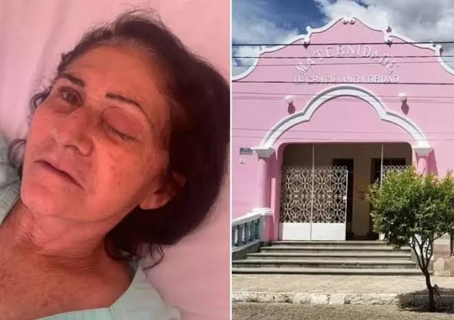 Oito pacientes perdem os olhos após mutirão de cirurgia de catarata
