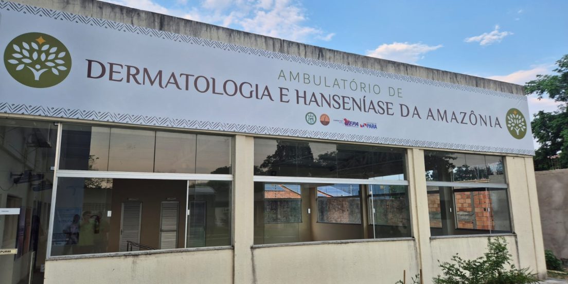 Ambulatório oferece tratamento dermatológico e de hanseníase em Marabá