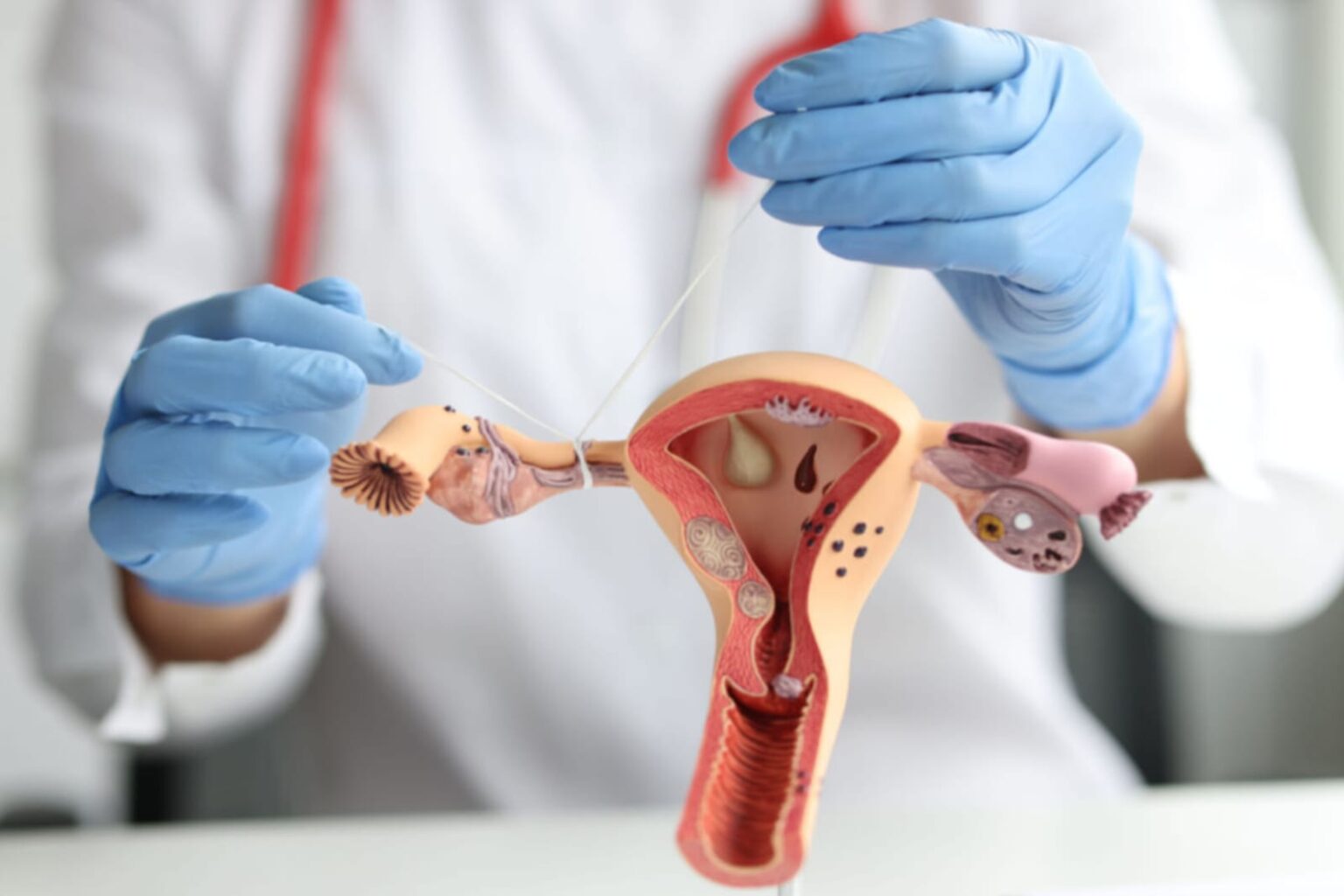 Laqueaduras: saiba como e quem pode solicitar a cirurgia