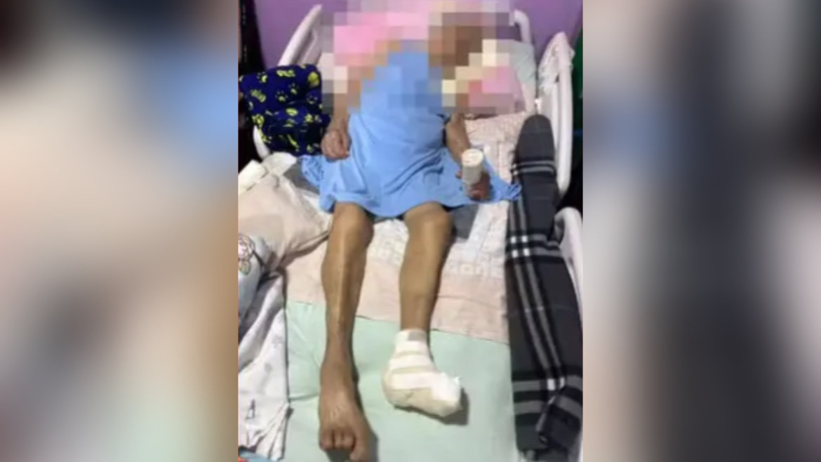 Idosa de 103 anos tem pé amputado sem anestesia em casa