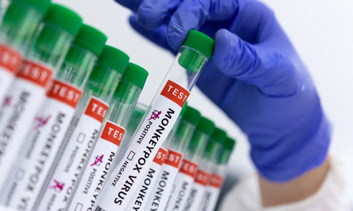 Sem casos de mpox, Marabá segue em estado de alerta para a doença