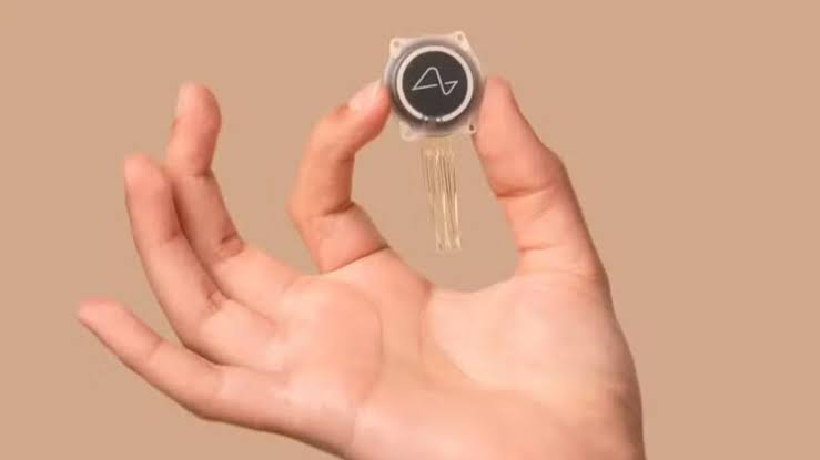 Implante cerebral da Neuralink permite a paciente digitar com o pensamento