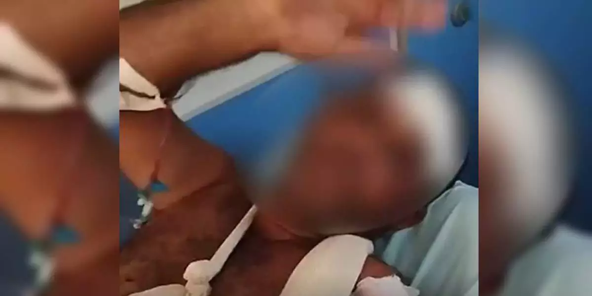 Vaqueiro é atacado por onça-pintada, se defende com facão e sobrevive