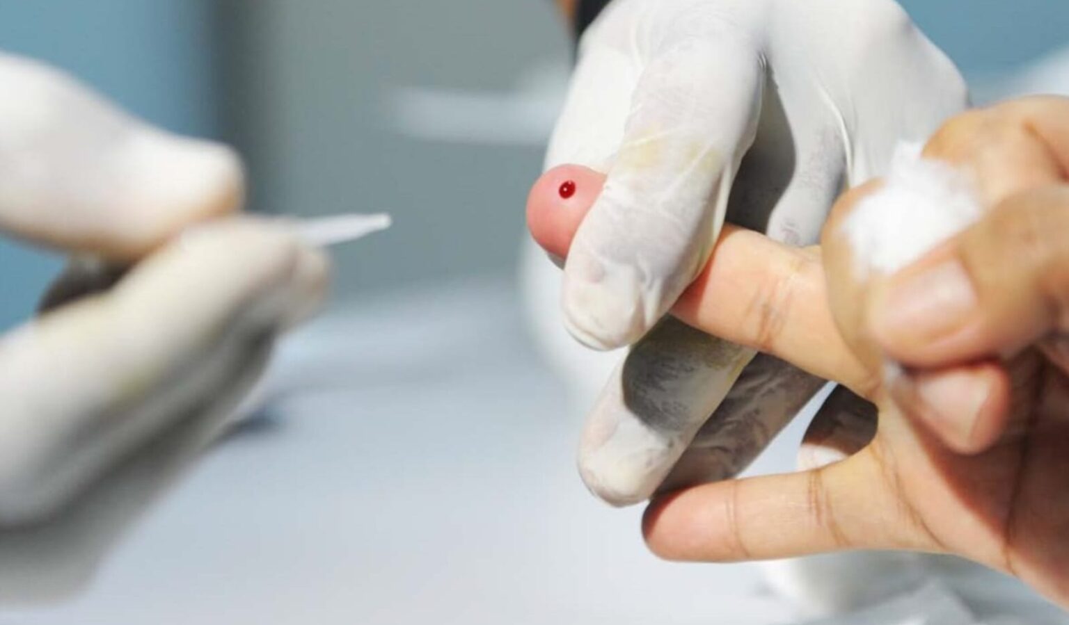 Cresce o número de casos de Hepatite A no Brasil; conheça os riscos
