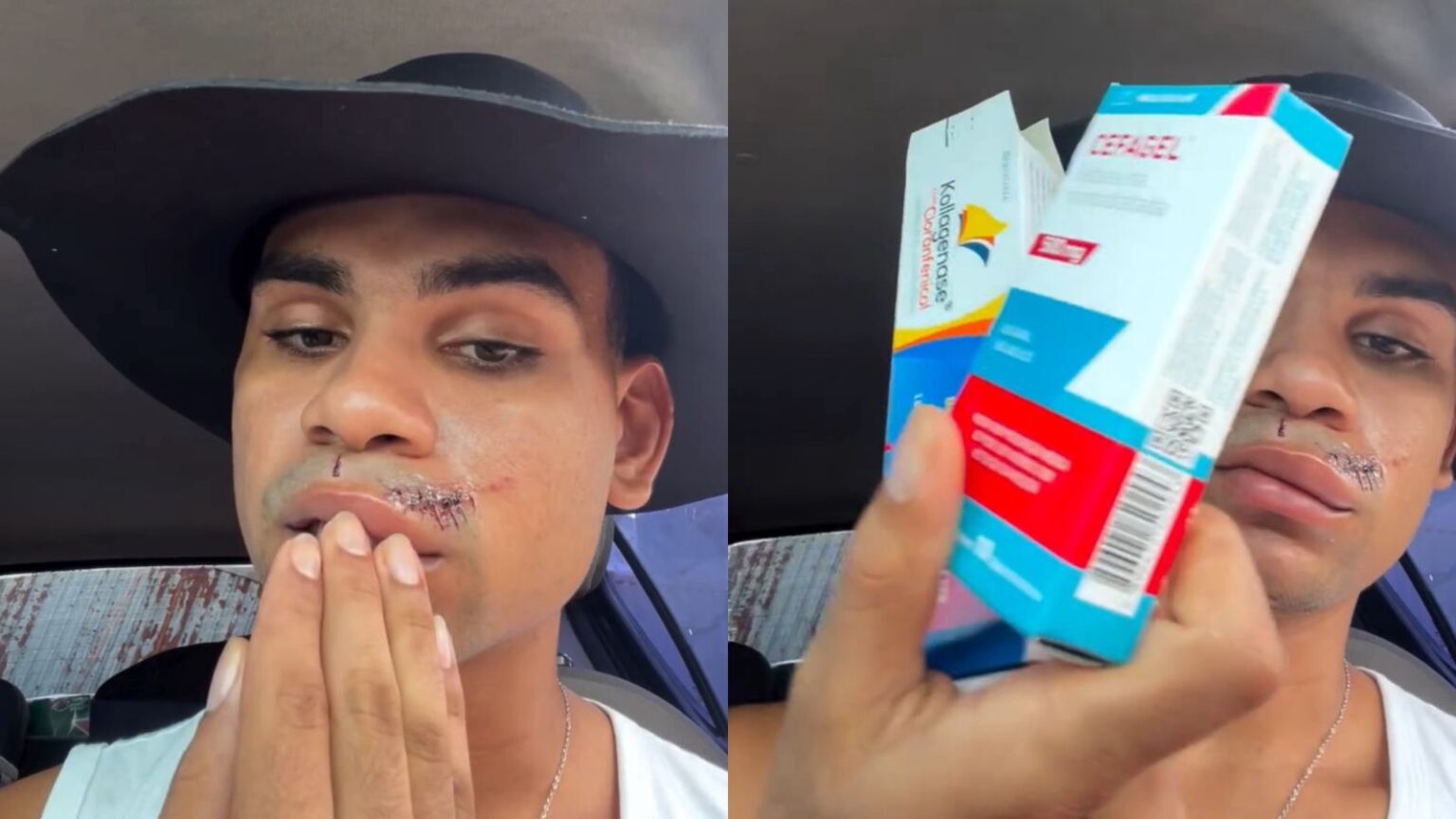 Entidade pede investigação após agressão a jovem LGBT+ em Curionópolis