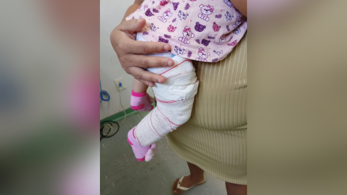 Homem agride companheira e chuta bebê de nove meses contra parede no Pará