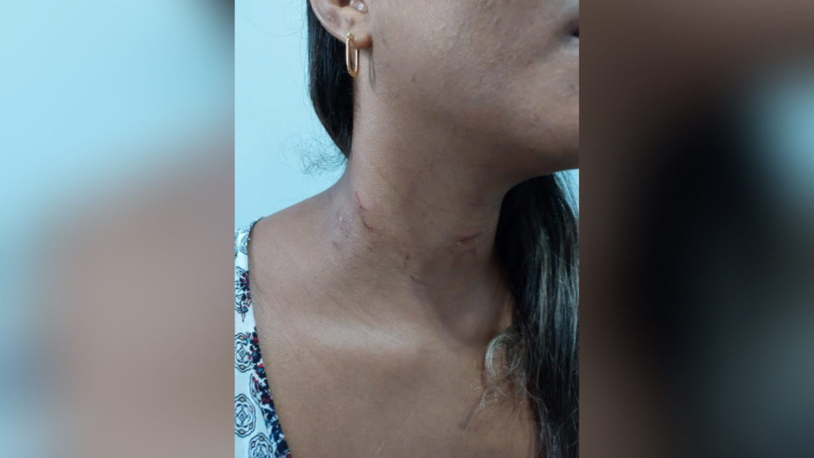 Homem agride esposa e se esconde no guarda-roupas da mãe no Pará