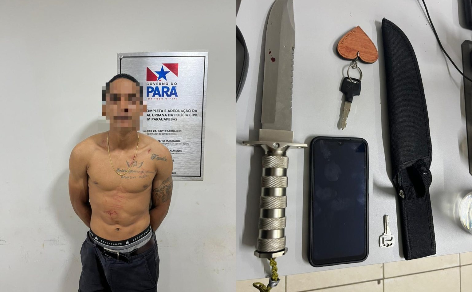 Mulher é esfaqueada pelo companheiro durante discussão em Parauapebas