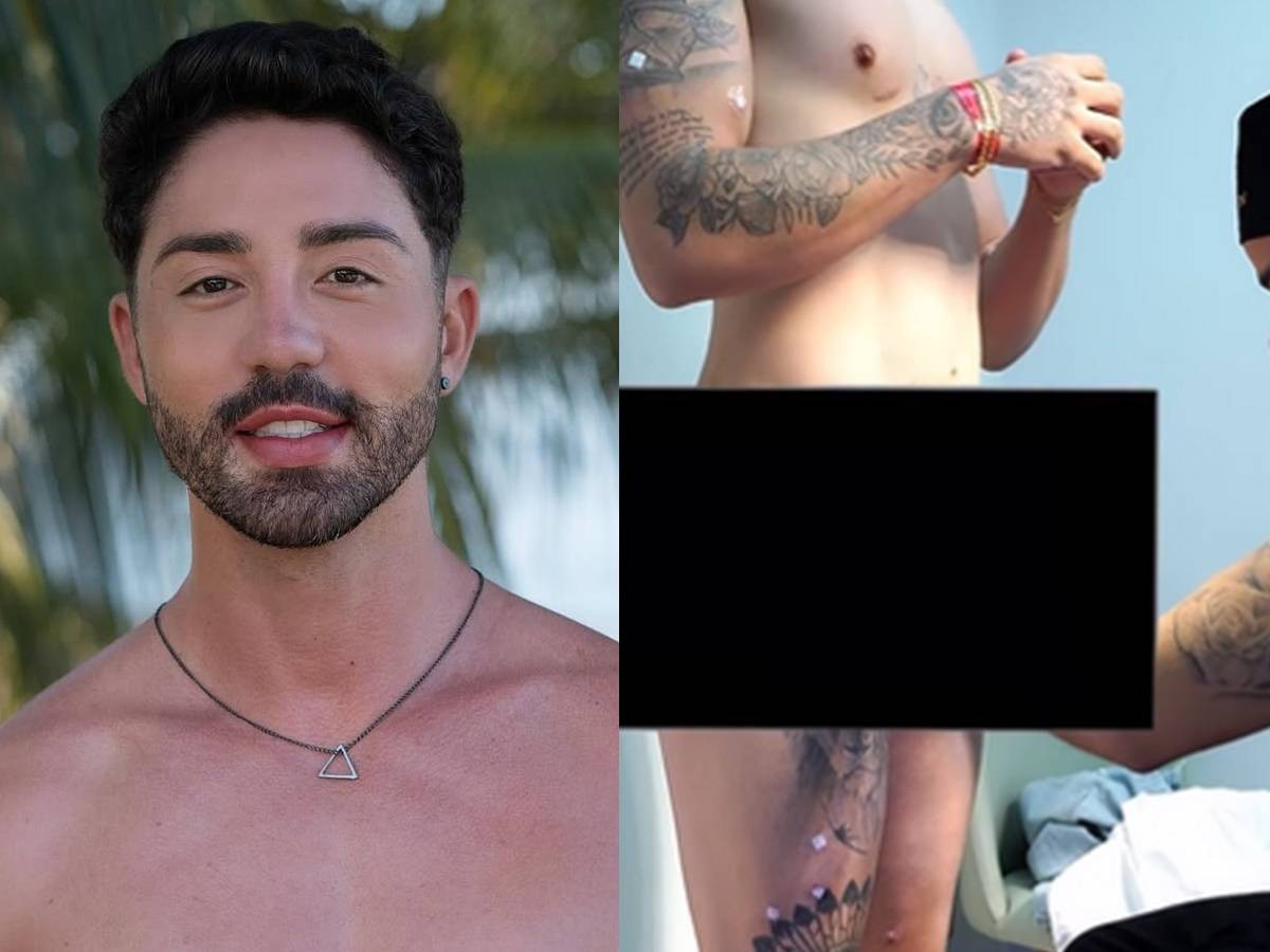 Rico Melquiades realiza harmonização peniana: “3 cm a mais”