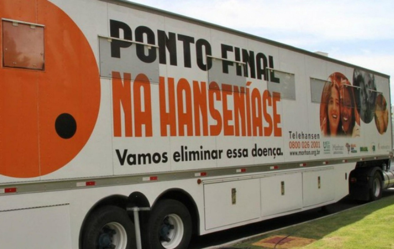 Marabá recebe Carreta Roda Hans para diagnóstico precoce da hanseníase