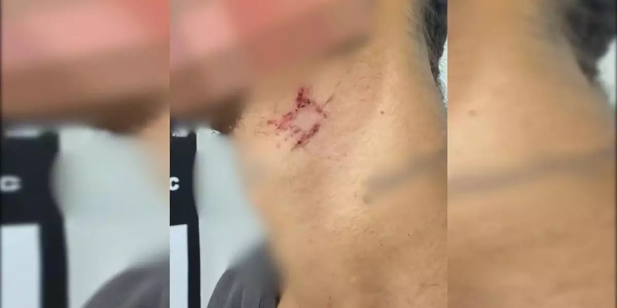 Homem é resgatado de cárcere após mais de um ano como escravo sexual de traficante