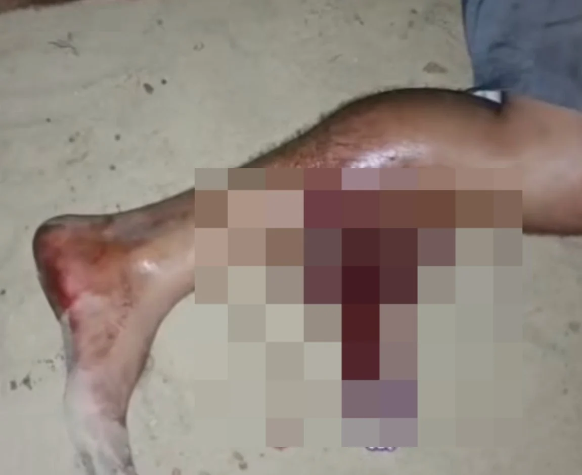 Homem é baleado na perna após agredir policiais durante abordagem no Pará