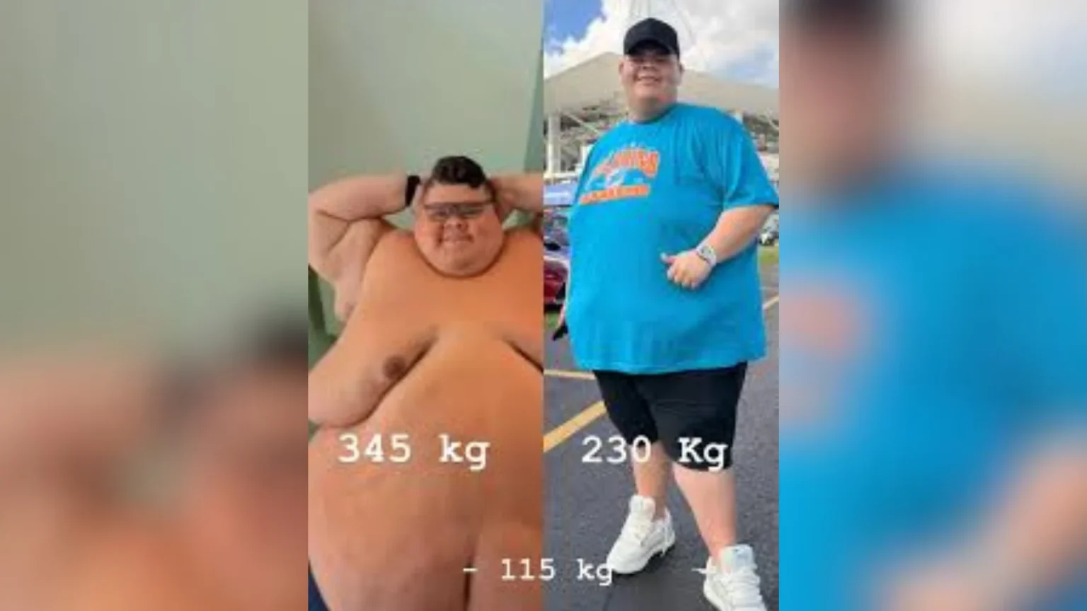 Transformação de Gordão da XJ: Antes e Depois Impressiona com Perda de 115 kg